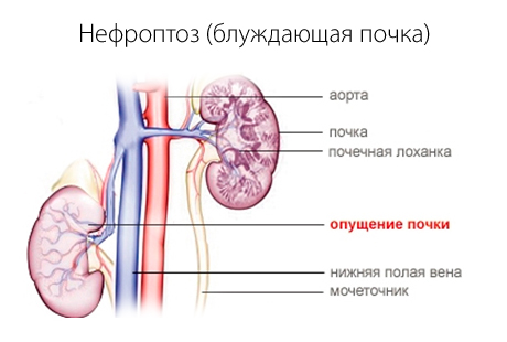 Основные виды опущений. Особенности лечения опущений.