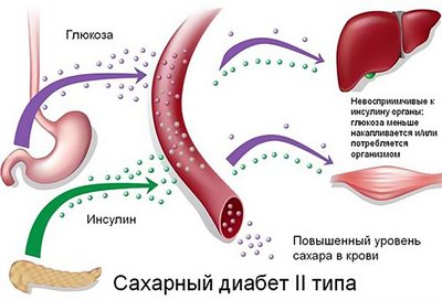 Установлена действенность препарата для диабетиков по контролю сахара в крови. 