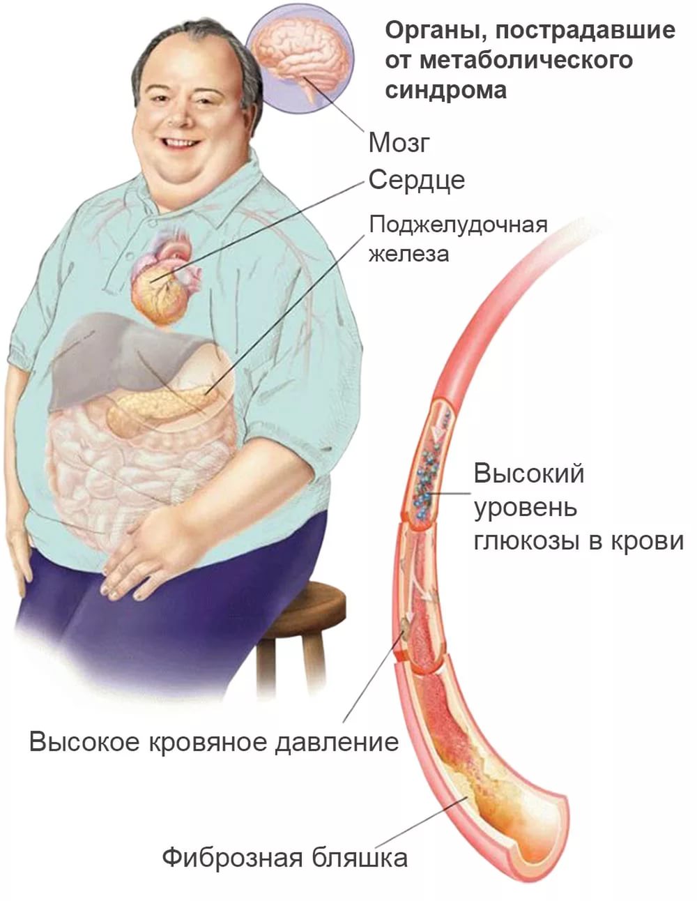 Ученые, о метаболическом синдроме и необходимости приема витамина Е.